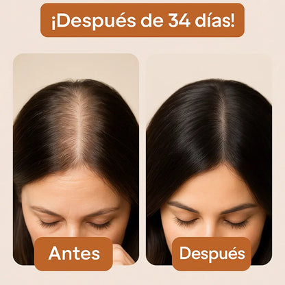 Aceite de Semillas Calabaza - RECUPERÁ TU PELO Y RECUPERÁ TU CONFIANZA